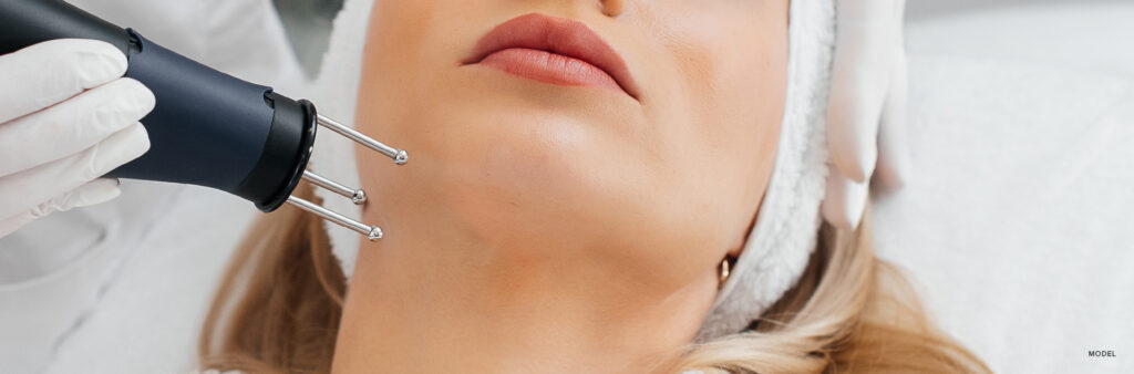 Laser Resurfacing Treatment