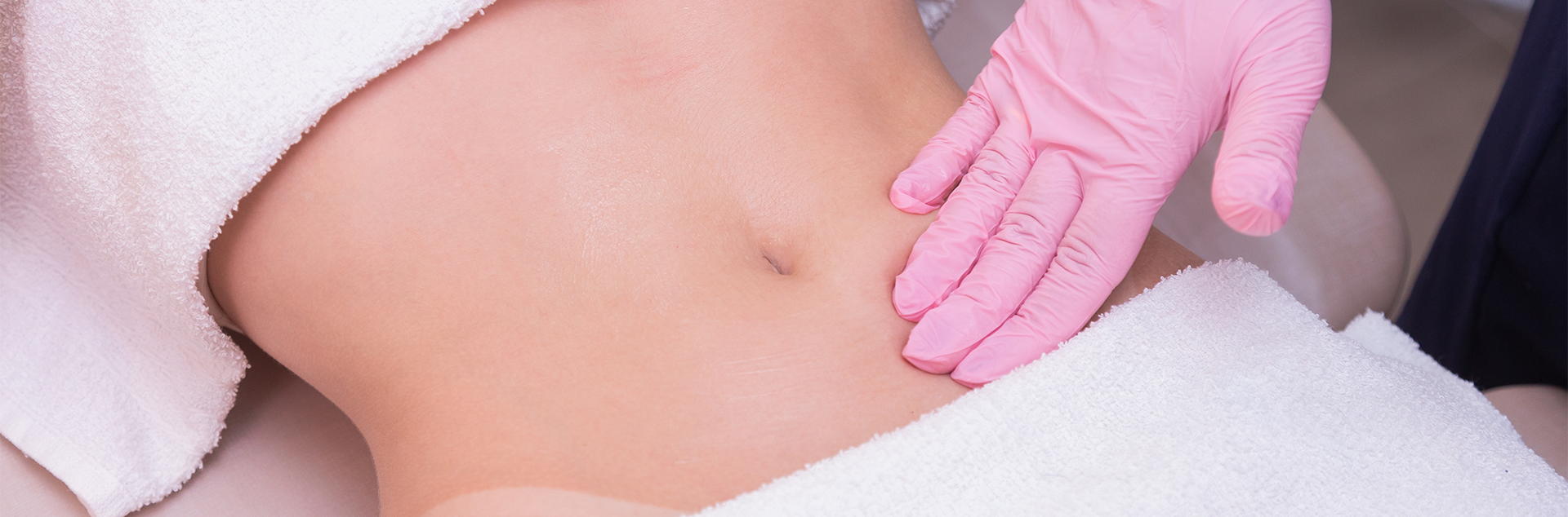 Laser Treatments for Stretch Marks