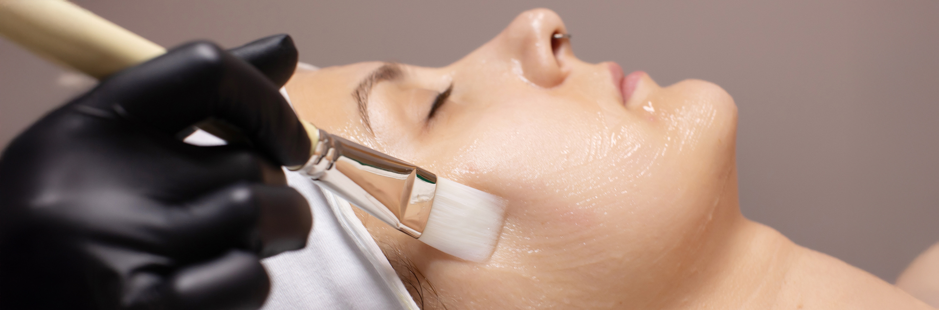 Chemical Peel for wrinkles