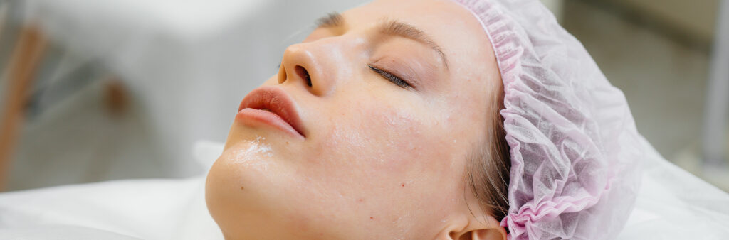 Are Chemical Peels Good for Your Face? A Guide to Radiant Skin 3 Are Chemical Peels Good for Your Face?