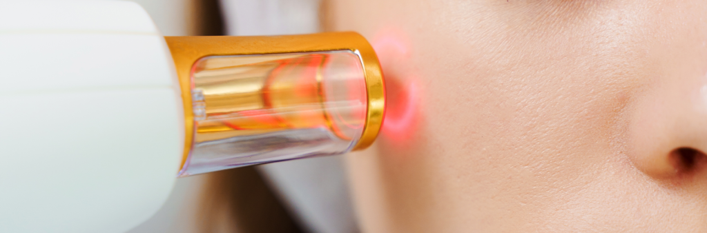 Laser Treatment For Sun Spots - Dose Aesthetics - Bowling Green, Ohio