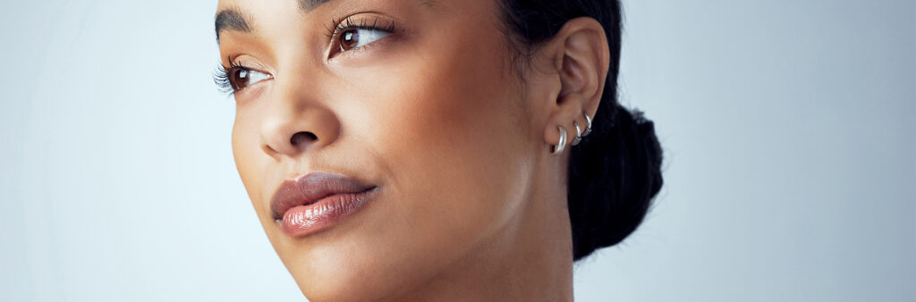 Acne Scars Removal - Dose Aesthetics - Bowling Green, Ohio