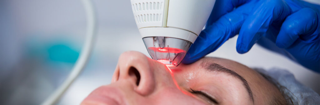 Laser For Dark Spots - Dose Aesthetics - Bowling Green, Ohio