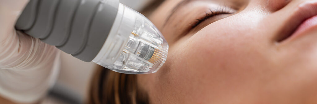 Tixel vs Microneedling - Dose Aesthetics - Bowling Green and Maumee, Ohio