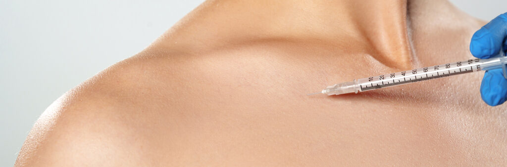Trapezius Tox - Dose Aesthetics - Bowling Green, Maumee, and Toledo, Ohio