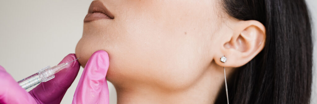 Masseter Tox - Dose Aesthetics - Bowling Green, Maumee and Toledo, Ohio