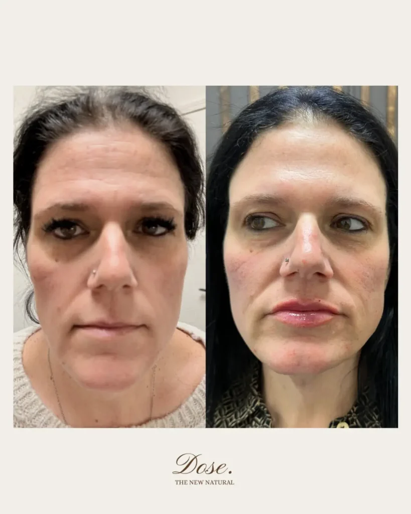 A gentle refresh the Dose way. Lets create your personalized plan ✨ 819x1024 1
