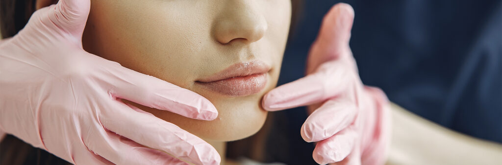 The Dose Method: How We Keep Lip Filler Looking Naturally Beautiful 5 Lip Filler