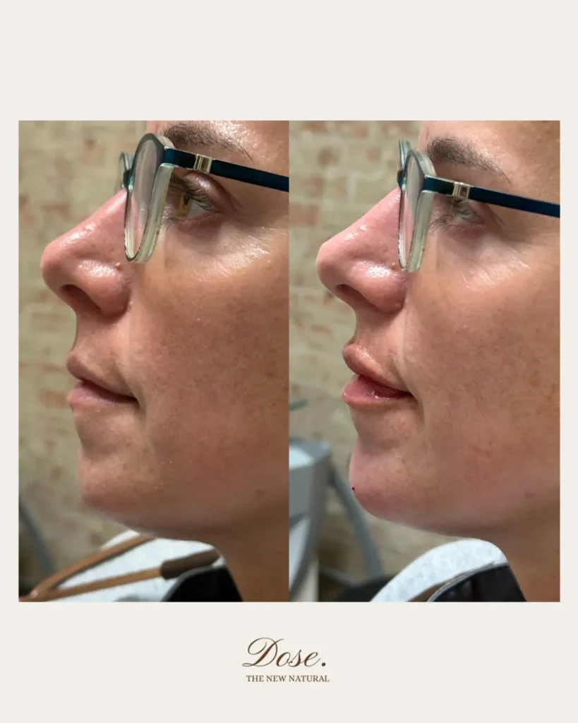 Never not loving a chin moment ✨ 819x1024 1