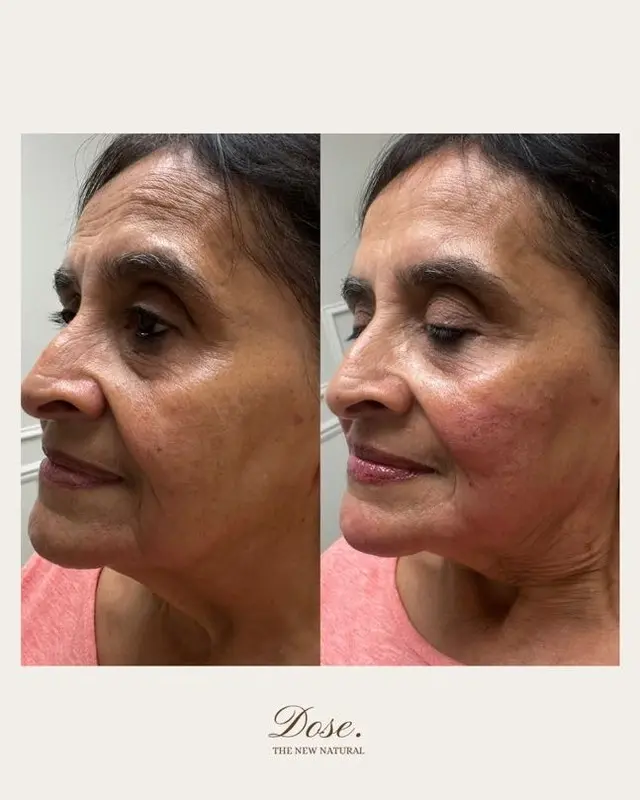 ✨ The best kind of transformation The one that has everyone saying You look so refreshed wit
